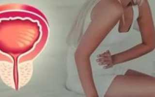 Мочеиспускание каждые 15-20 минут