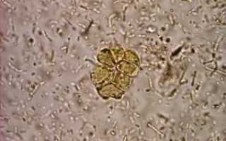 BLASTOCYSTIS HOM