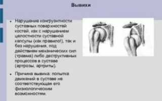 Нарушение конгруэнтности суставных поверхностей при трехлодыжечном переломе