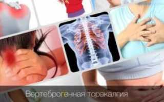 Вертеброгенная торакалгия не проходит. Что делать?