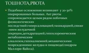 Тошнота после операции