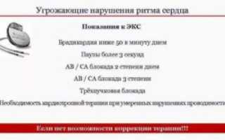 Сбой сердечного ритма два удара с 2-х секундной паузой минуту