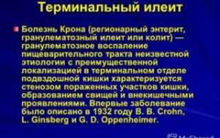 Терминальный илеит