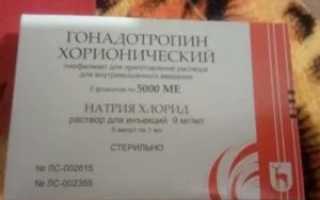 Укол хгч 5000