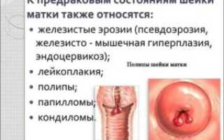 Болезни шейки матки
