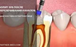 Зуб после перелечивания каналов болит, что делать?
