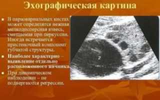 Кистозное образование с пристеночным компонентом