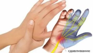 Плохо работает кисть и пальцы левой руки