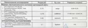 Тиреотоксикоз анализы расшифровка