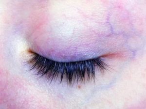 Под кожей века вена?