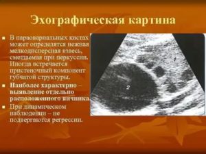 Кистозное образование с пристеночным компонентом