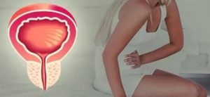 Мочеиспускание каждые 15-20 минут