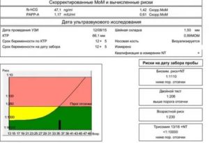 Риск по т 21 на Первом скрининге