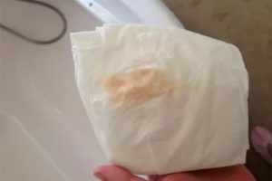 Розовые выделения после полового акта