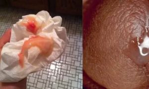 Розовые выделения после полового акта