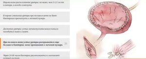 Цистит только после оргазма