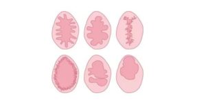 Можно ли травмой повредить девственную плеву?