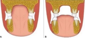 Положение языка во рту
