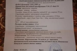 Отмена Дюфастона если ещё нет беременности