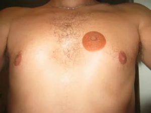 Камушки в сосках