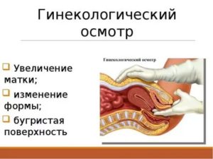 Увеличена матка