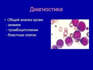 ОАК, бласты