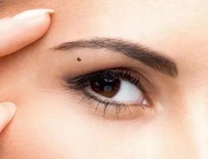 Родинка на брови