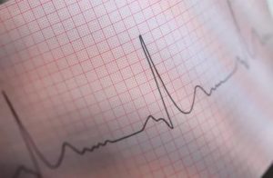 Тахикардия на фоне орви