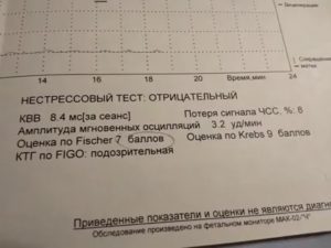 Расшифровка КТГ, оценка по Фишер 8, Кребс 10, нестрессовый тест положительный