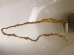 Серые пленки в кале