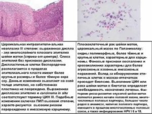 Результат кольпоскопии, пролиферация железистого эпителия
