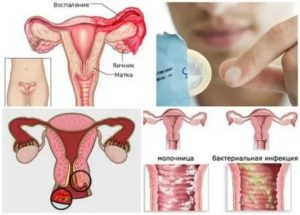 Зуд и жжение у партнерши после полового акта, причины