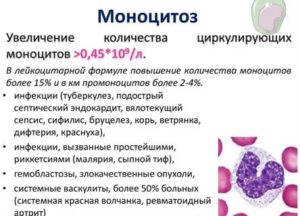 Повышены моноциты% у ребенка 12 лет. Моноцитоз?