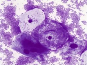 В мазке коккобациллярная флора