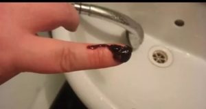 Коричневые выделения через месяц после чистки матки