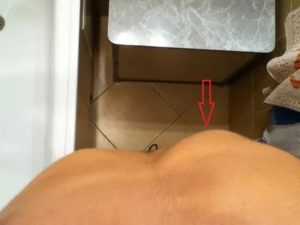 Шишка в районе солнечного сплетения
