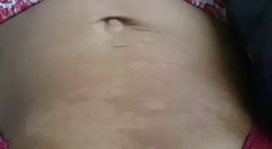 Пятна на животе справа от пупка коричневого цвета