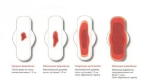 Скудные менструации после окончания грудного вскармливания
