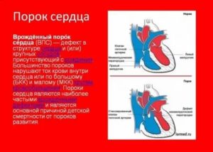 Как жить с пороком сердца?