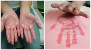 Ребенок часто потеет, холодный лоб, кожа рук и ножек