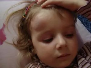 Мягкая шишка на лбу