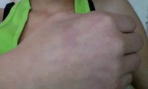 Пятно на руке фиолетового цвета