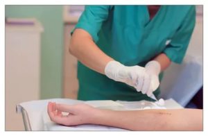 Ревизия раны после операции