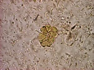BLASTOCYSTIS HOM