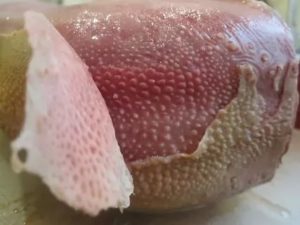 Проблемы с крайней плотью, белый налет, боли