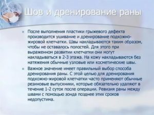 Ревизия раны после операции