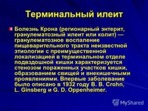 Терминальный илеит
