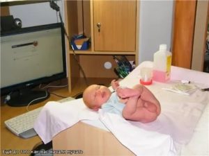 Сделали обрезание сыну