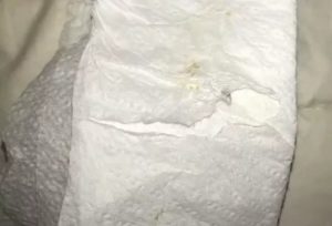 Светло-бежевые выделения от утрожестана