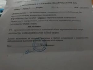 Расшифровка мазка из носа на лейкоформулу